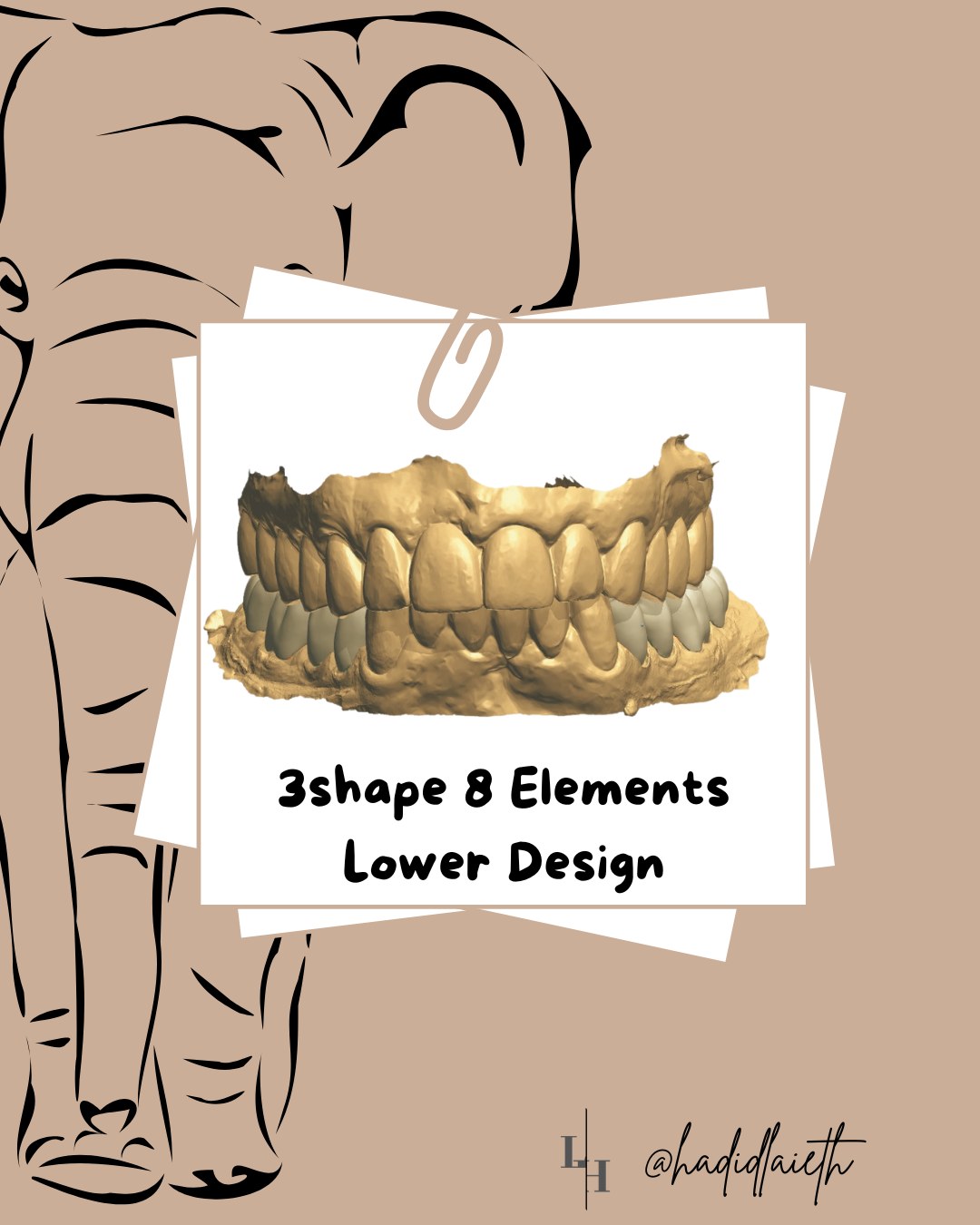 3Shape 8 Elements lower design, front view of the digital model