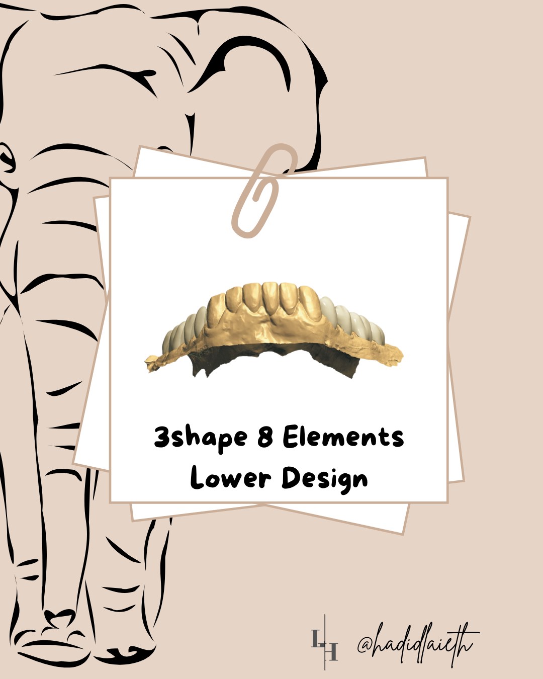 Instagram post: 3Shape 8 Elements lower design, occlusal view