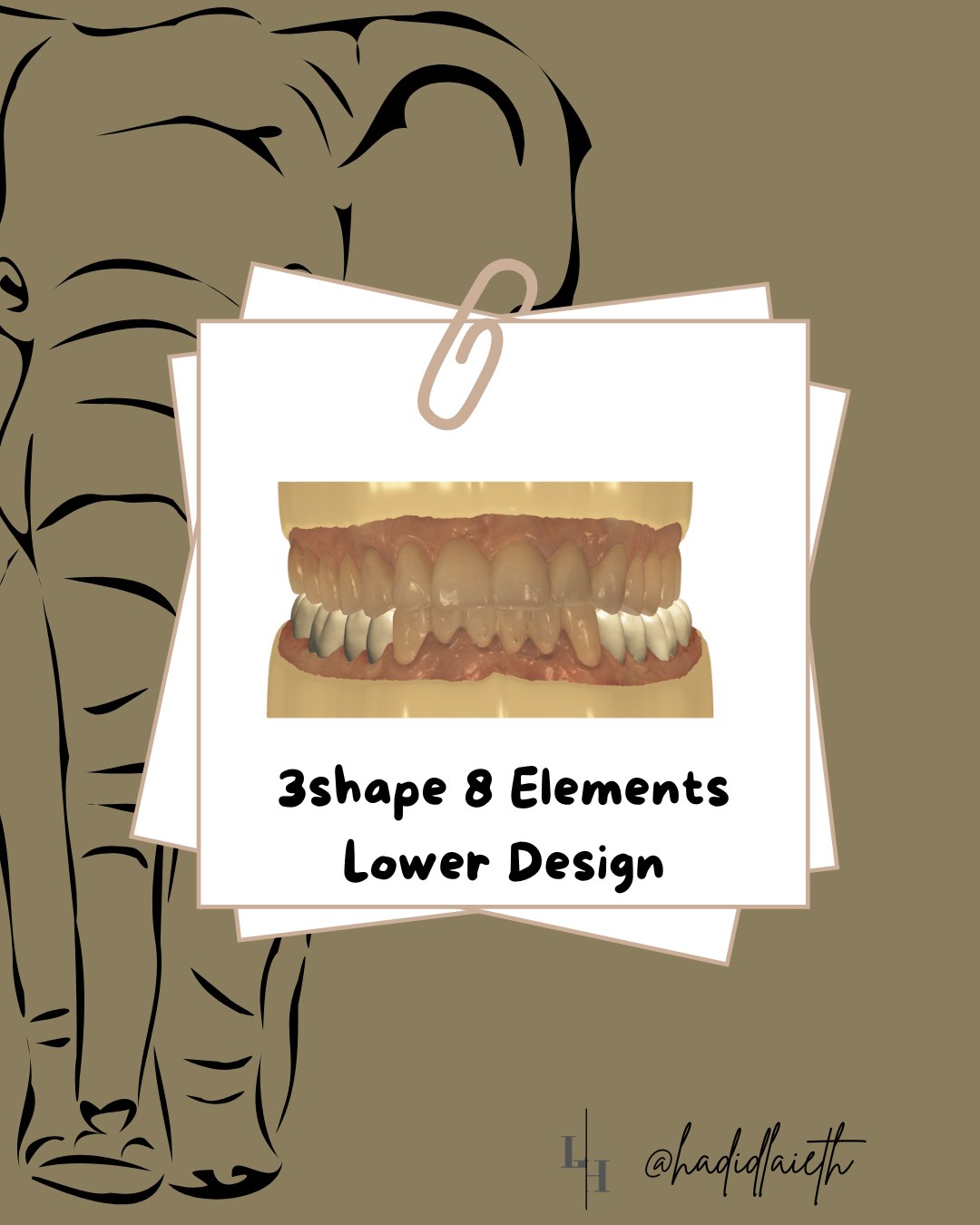 Instagram post: 3Shape 8 Elements lower design, front view